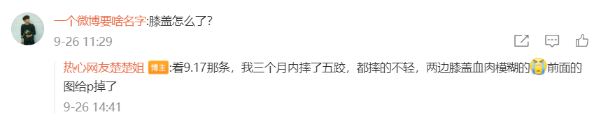 Coser为还原角色有多拼?有人带伤上阵,妹子直接剃“剃光头”